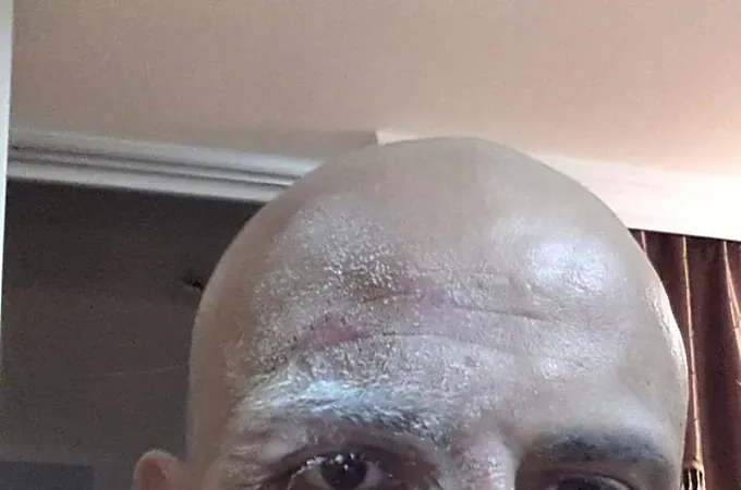 Είναι καλά ο Πανούσης